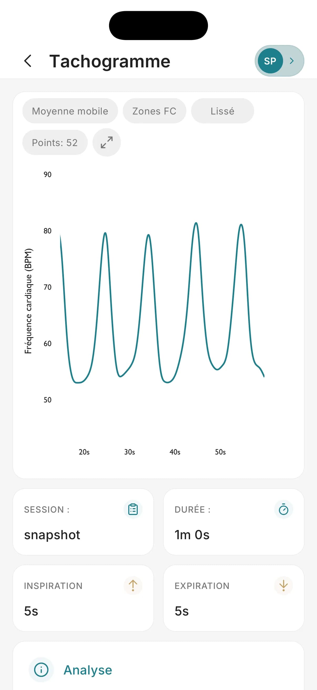 Analyses graphiques avancées screenshot 1